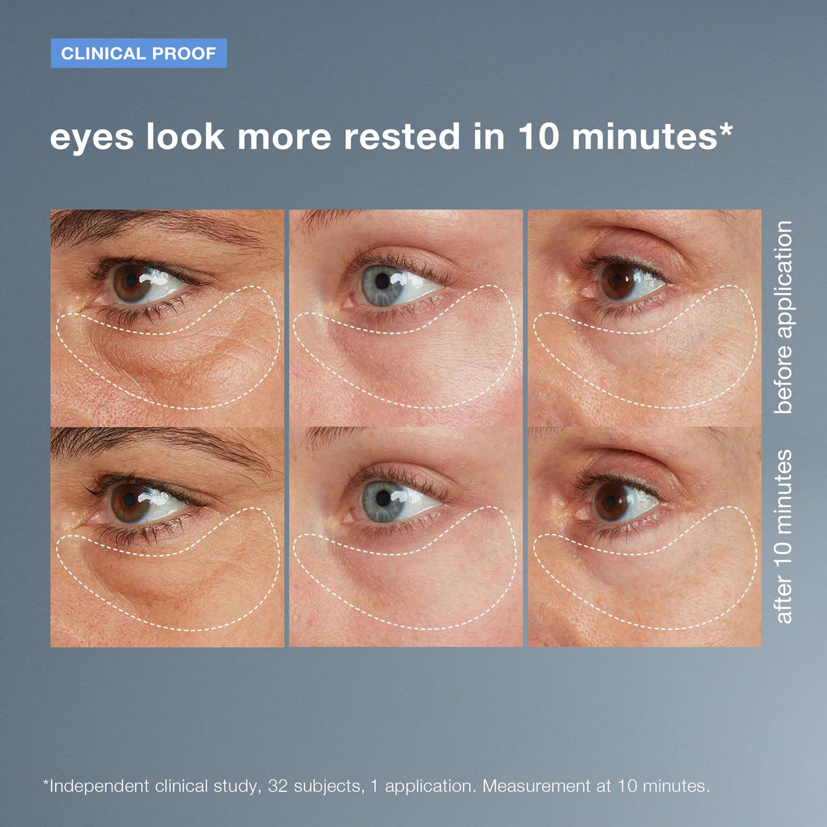 awaken peptide depuffing eye gel