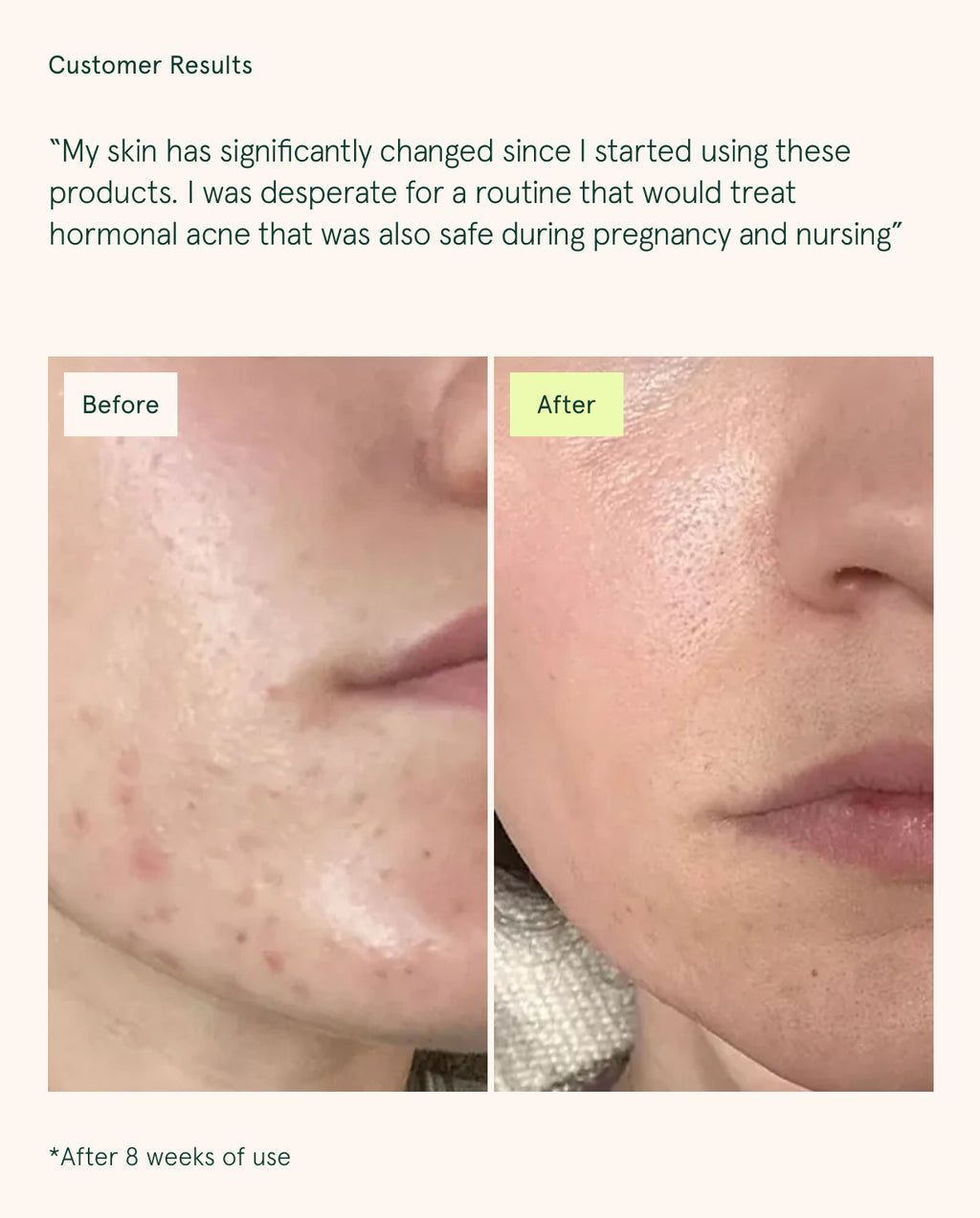 Core Four (Retinoid Alternative)