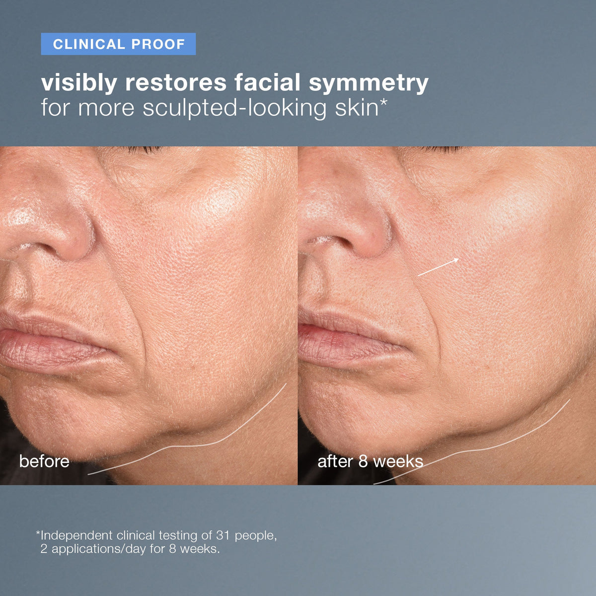 neurotouch symmetry serum