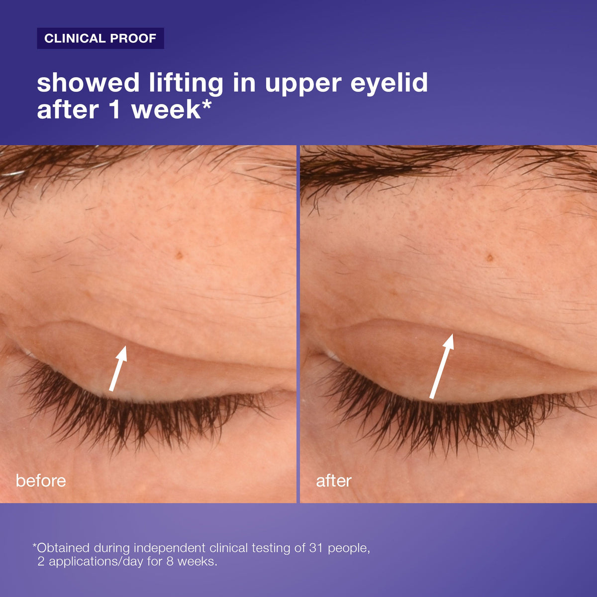 phyto nature lifting eye cream