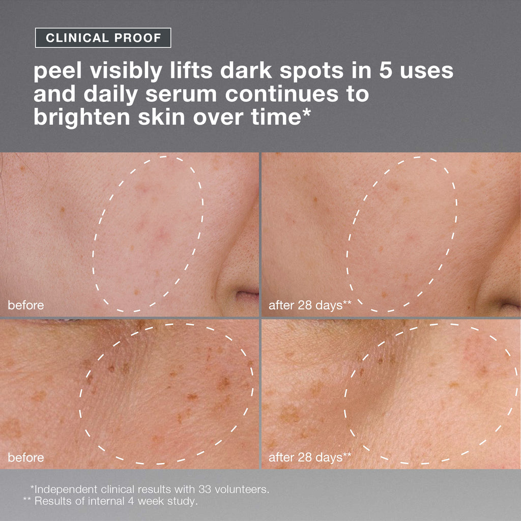 powerbright dark spot system (2 full-size)