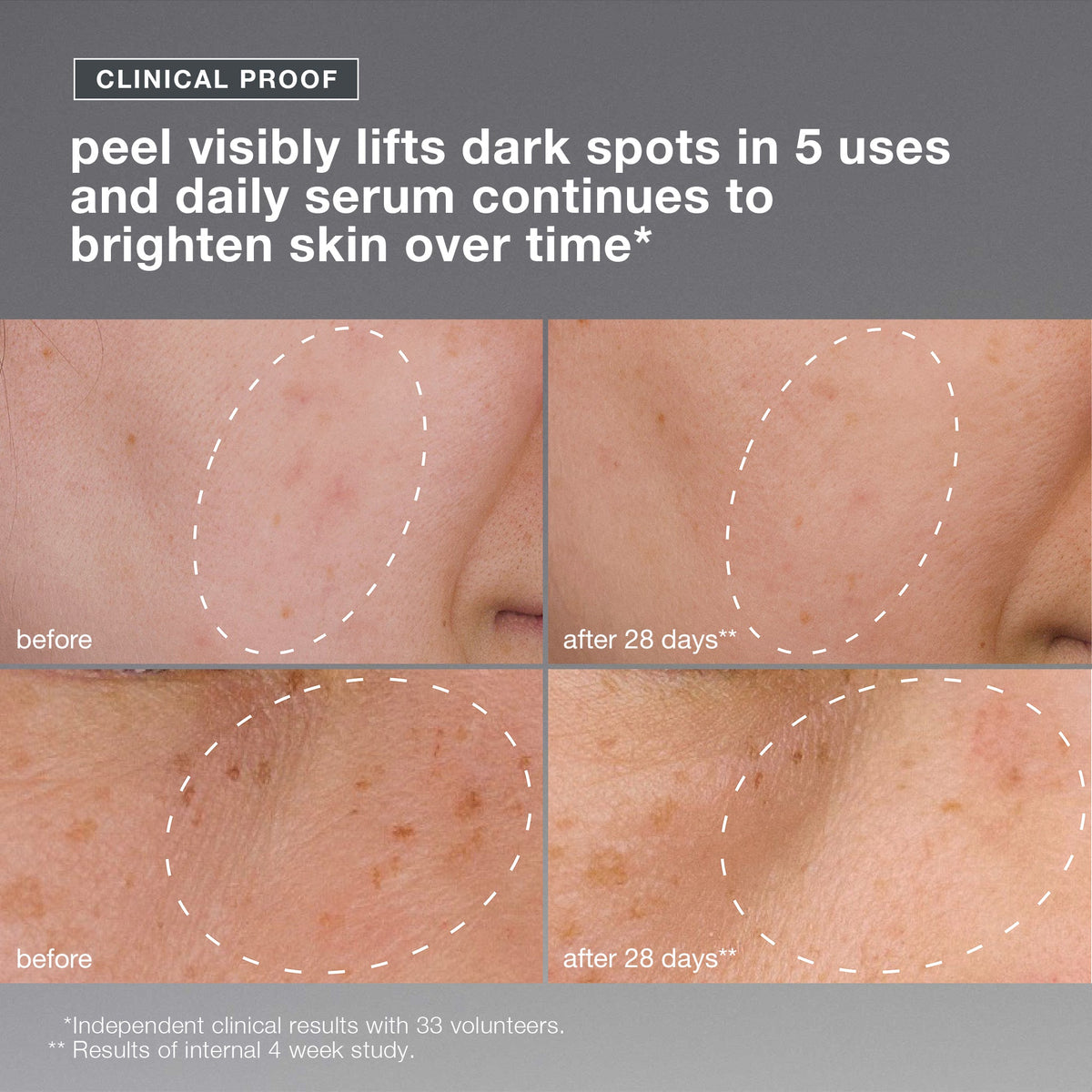powerbright dark spot system (2 full-size)