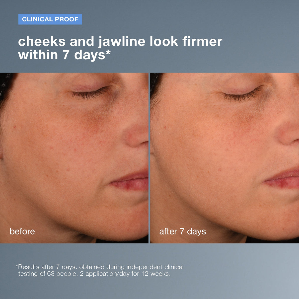 pro-collagen banking serum