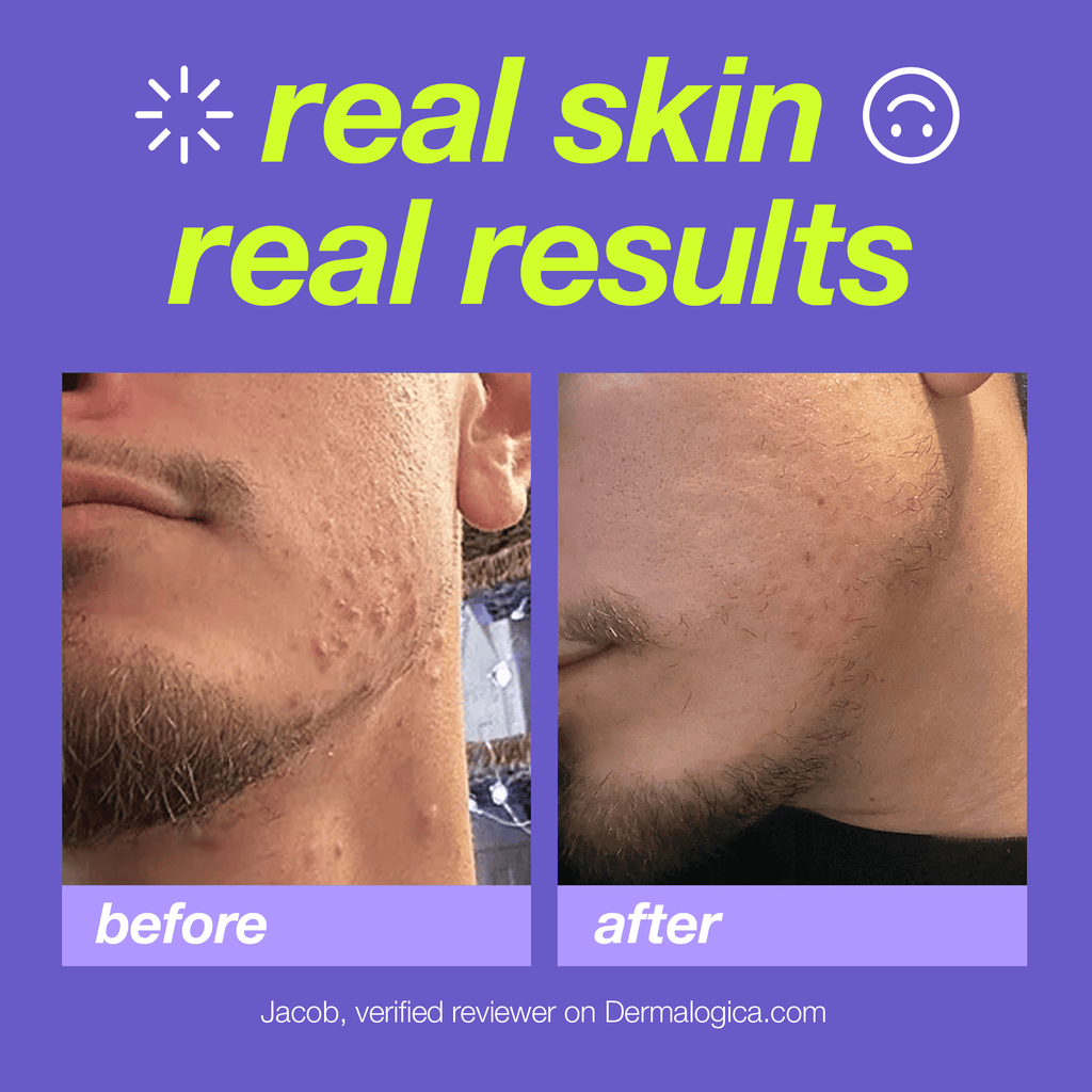 breakout clearing foaming wash