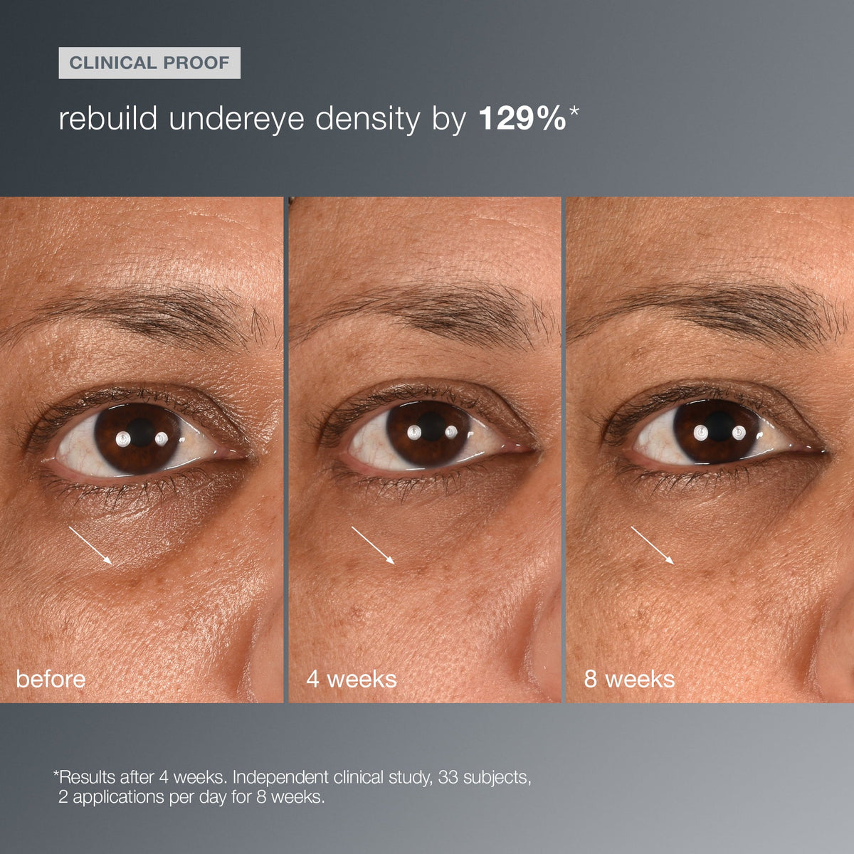 smart eye density undereye serum