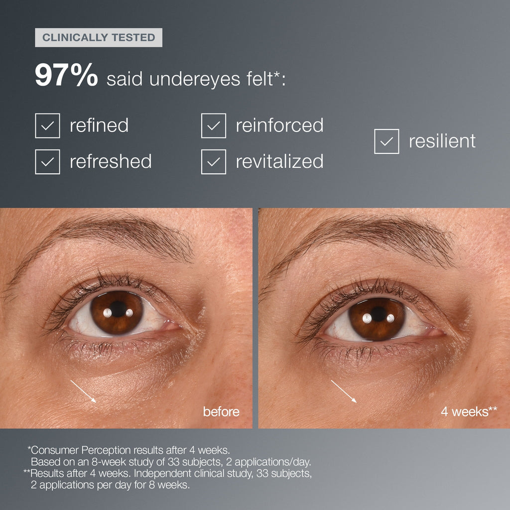 smart eye density undereye serum