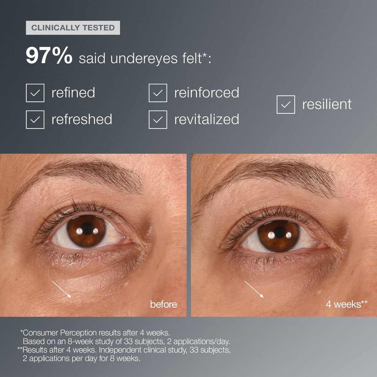 smart eye density undereye serum