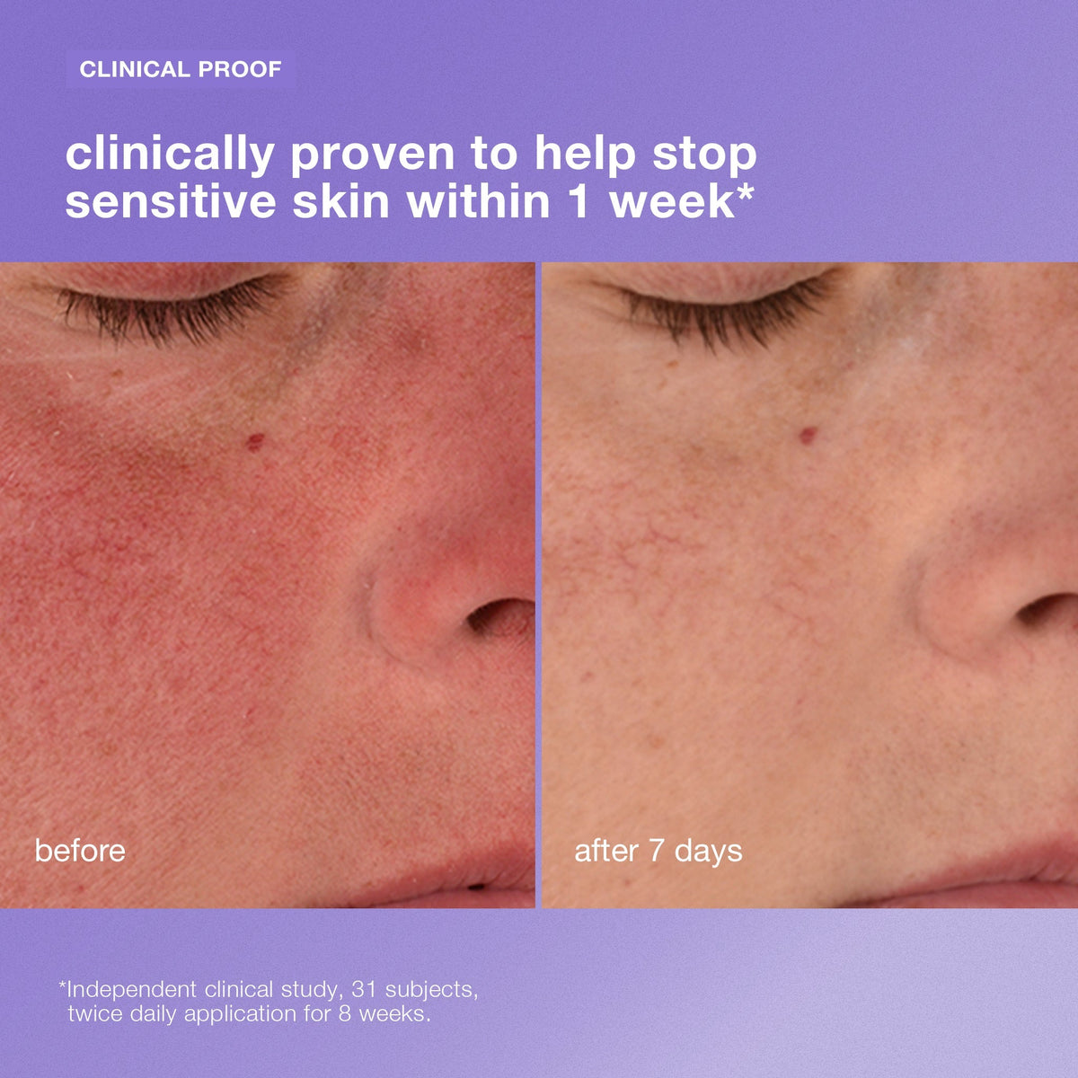 stabilizing repair cream