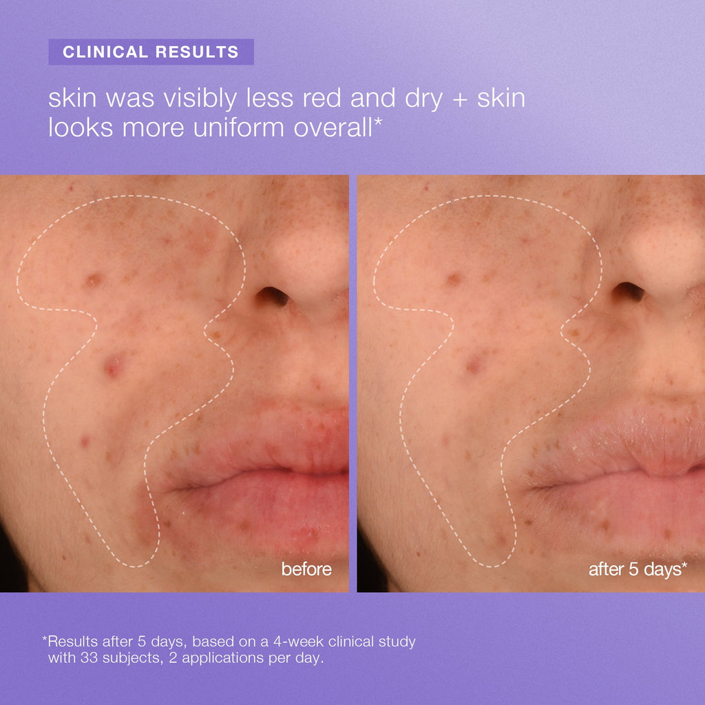 stabilizing repair face + body serum