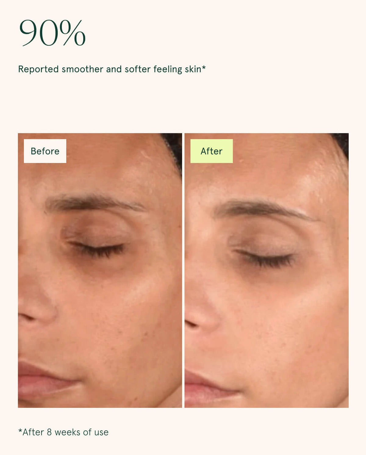 Toning Pads