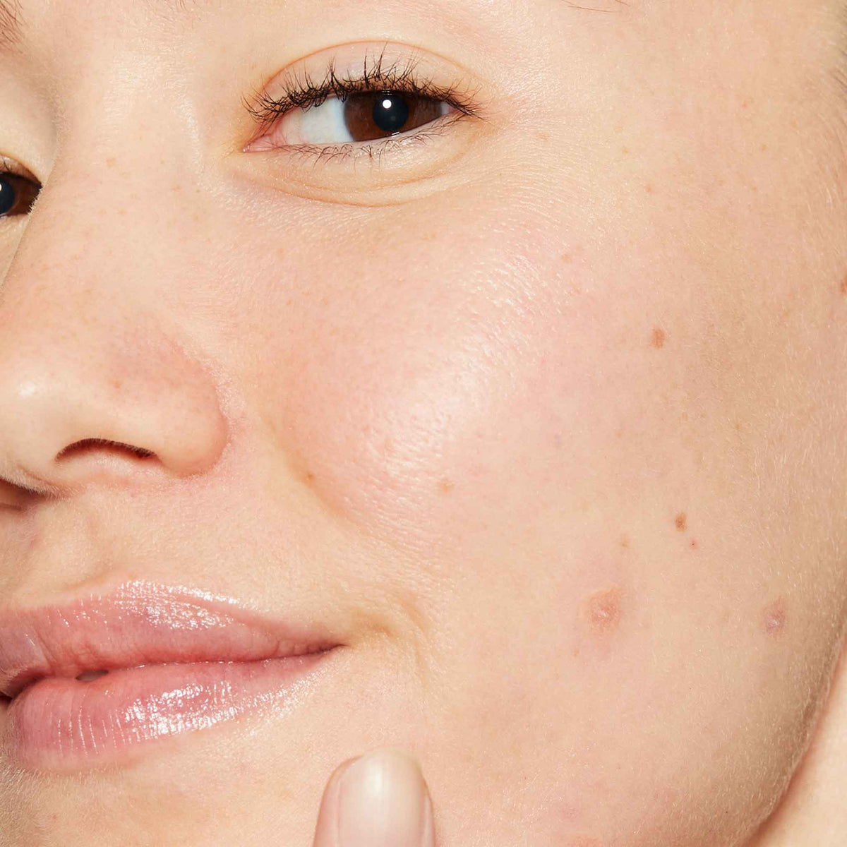deep acne invisible liquid patch