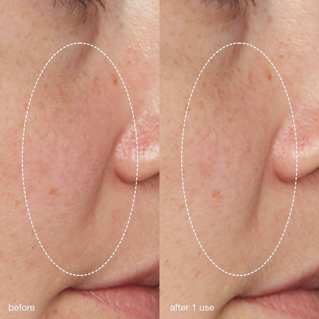 liquid peelfoliant